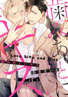 噛みあとにキス