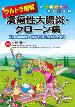 ウルトラ図解　潰瘍性大腸炎・クローン病