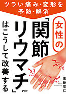 ツライ痛み・変形を予防・解消 女性の「関節リウマチ」はこうして改善する