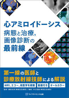 心アミロイドーシス　病態と治療，画像診断の最前線