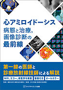 心アミロイドーシス　病態と治療，画像診断の最前線