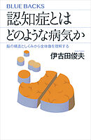 認知症とはどのような病気か　脳の構造としくみから全体像を理解する