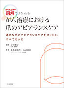 がん治療における爪のアピアランスケア　オールカラー図解でよくわかる