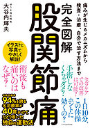 完全図解 股関節痛