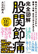 完全図解 股関節痛