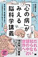 「心の病」がみえる脳科学講義～精神疾患・発達障害を持つ人の頭の中で何が起きているのか