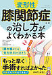変形性膝関節症の治し方がよくわかる本