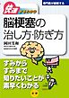 脳梗塞の治し方・防ぎ方 : 快速まるわかり