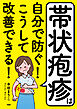 帯状疱疹は自分で防ぐ！ こうして改善できる！