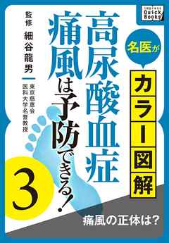 名医がカラー図解！ 高尿酸血症・痛風は予防できる！ (3) 痛風の正体は？