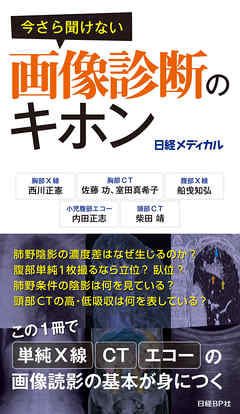 今さら聞けない画像診断のキホン - 西川正憲 | Gracelutheranbtown.org 今さら聞けない画像診断のキホン - 西川正憲 | Gracelutheranbtown.org
