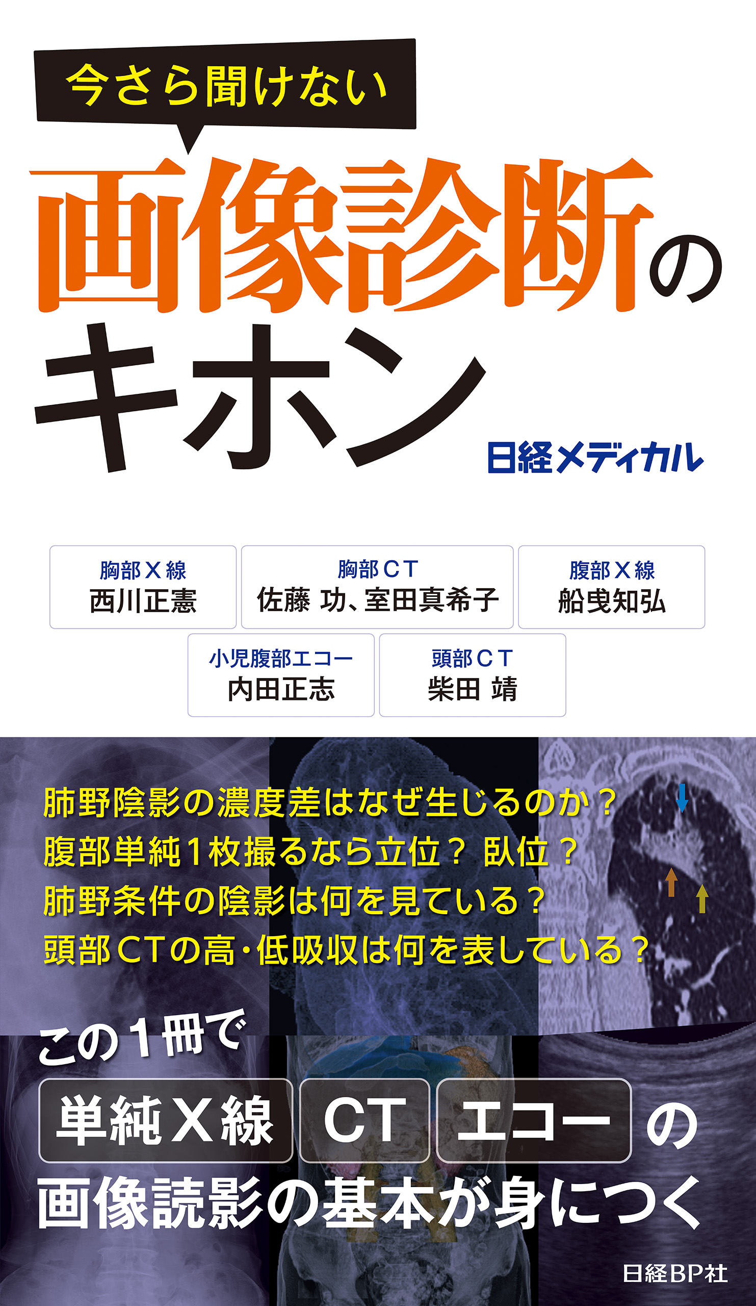 今さら聞けない画像診断のキホン | ブックライブ