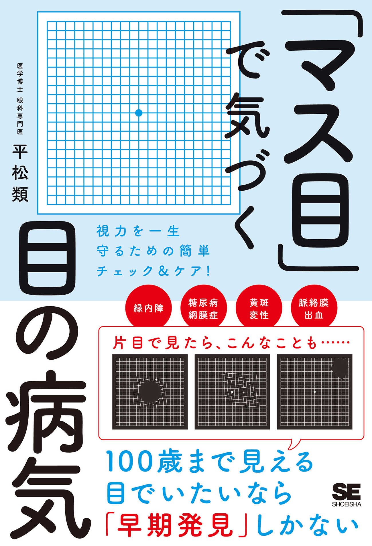 マス目 で気づく目の病気 視力を一生守るための簡単チェック ケア 平松類 漫画 無料試し読みなら 電子書籍ストア ブックライブ