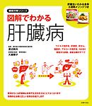 図解でわかる肝臓病