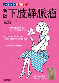 新版　下肢静脈瘤