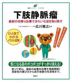 下肢静脈瘤　最新の日帰り治療できれいな足を取り戻す