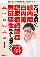失明を招く　緑内障　白内障　糖尿病網膜症　黄斑変性を解消するスゴワザ