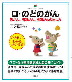 口・のどのがん　舌がん、咽頭がん、喉頭がんの治し方